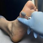 Pedikűrös csiszolósapka 7mm 10db - #180 - Perfect Nails