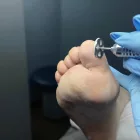 Pedikűrös Csiszolókorong tartó - 15mm - Perfect Nails